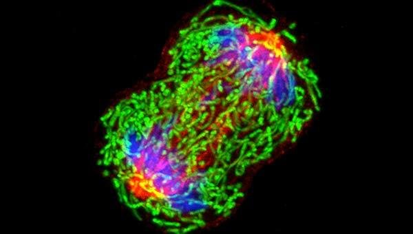 A dividing breast cancer cell